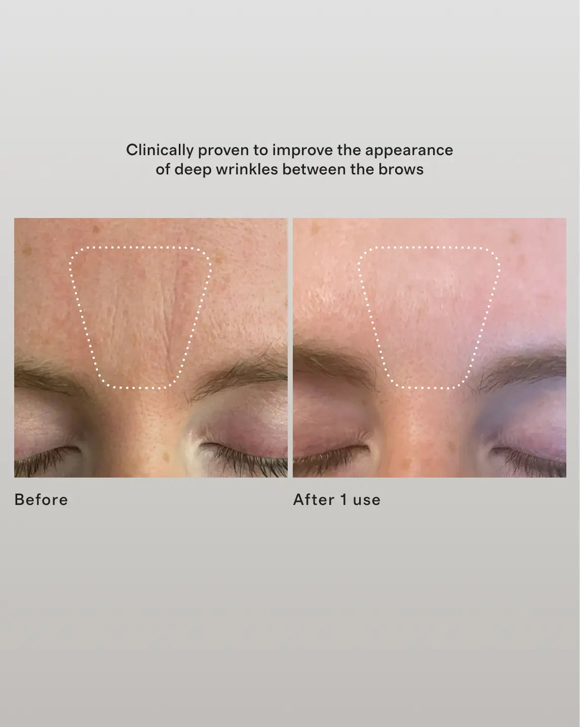 Wrinkle Erasing Retinol Patches by 111SKIN - US 5101