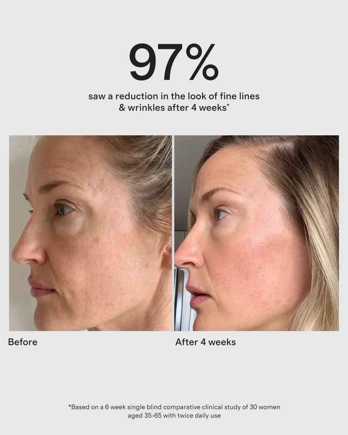 Chebula Active Serum by True Botanicals - US 2491