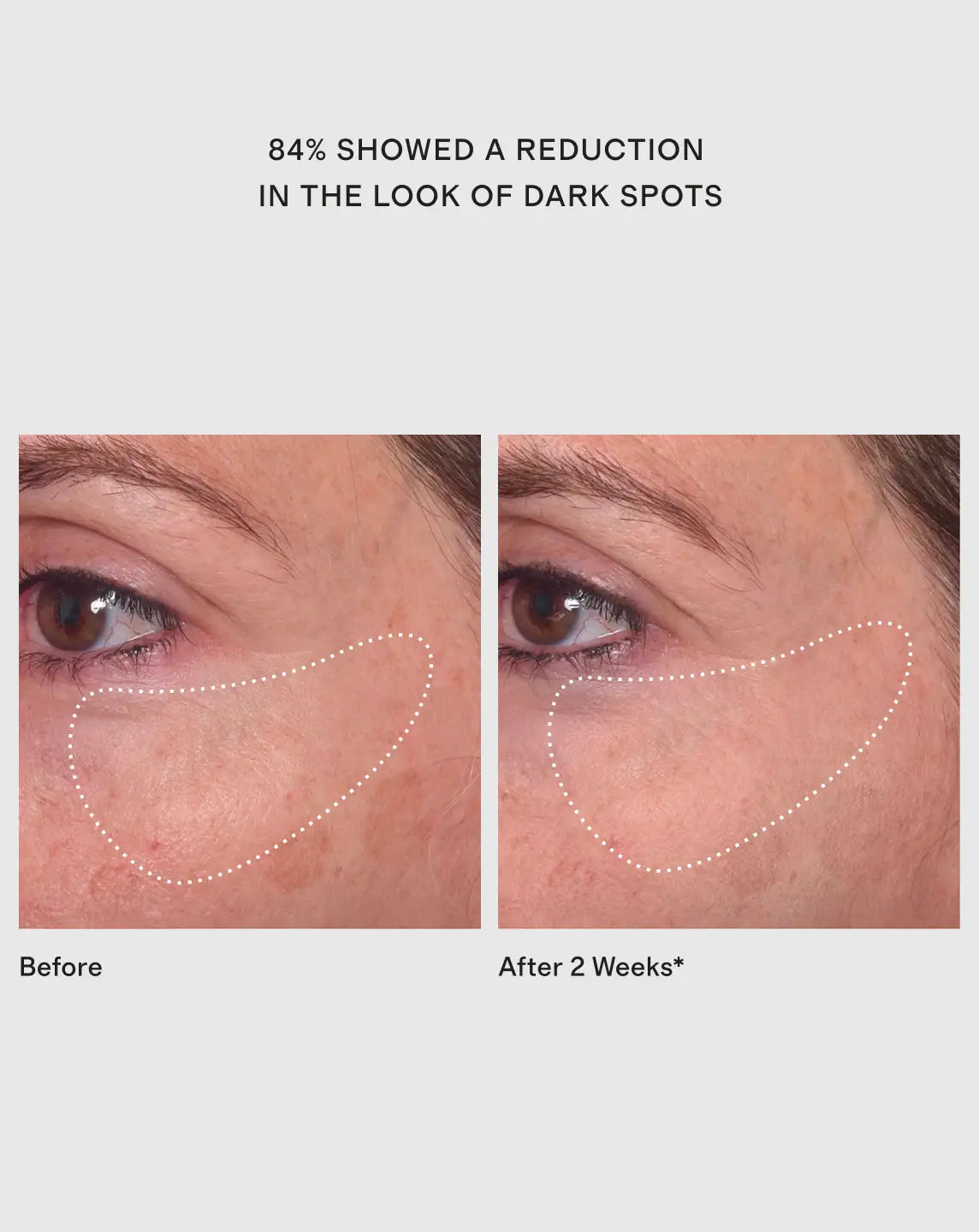 Rapid Dark Spot Correcting Serum by Murad - US 1804