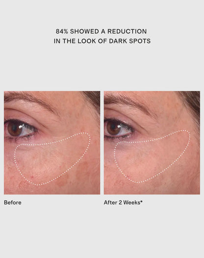 Rapid Dark Spot Correcting Serum by Murad - US 1804