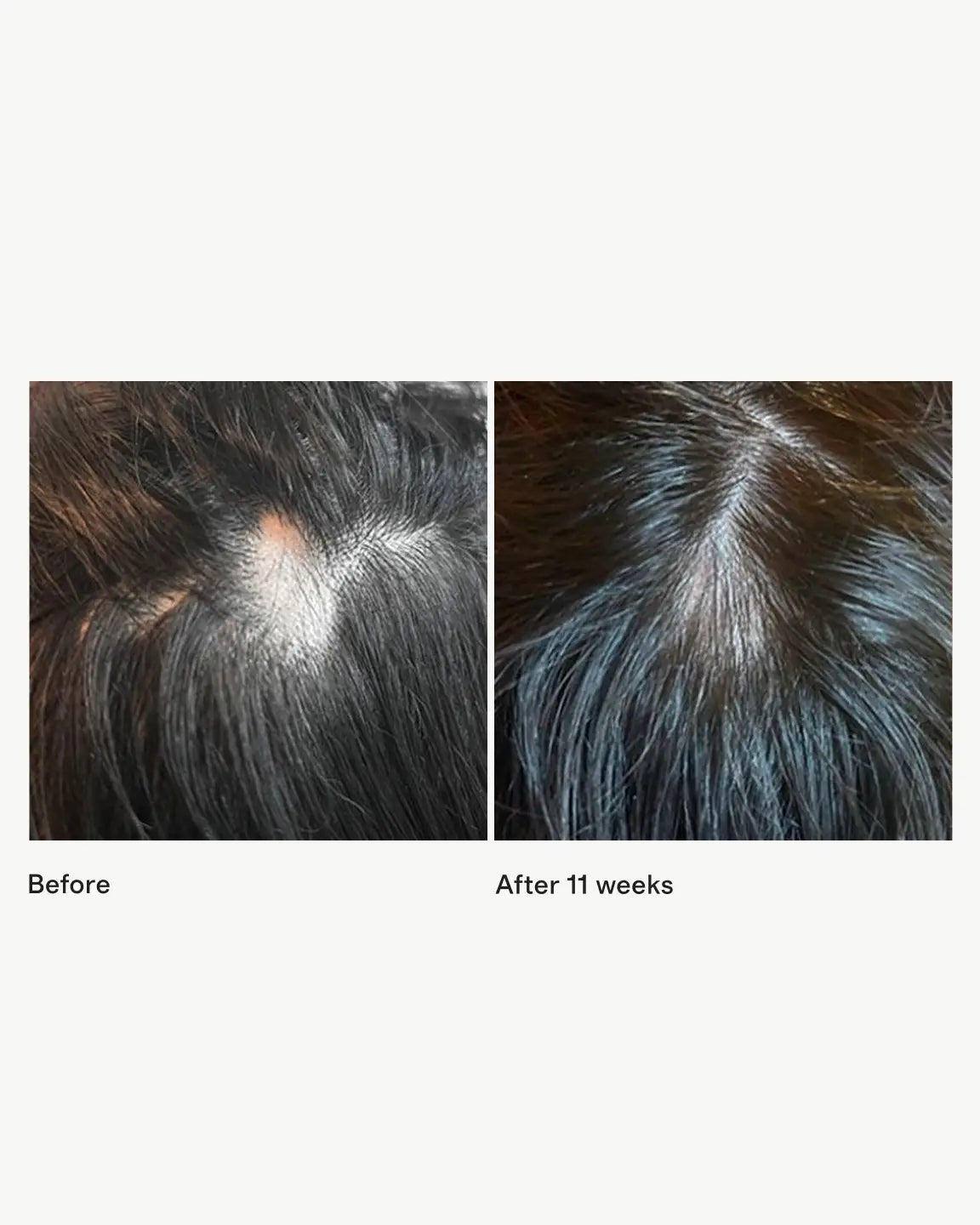 Scalp + Hair Rejuvenating Booster by Iles Formula - US 9585