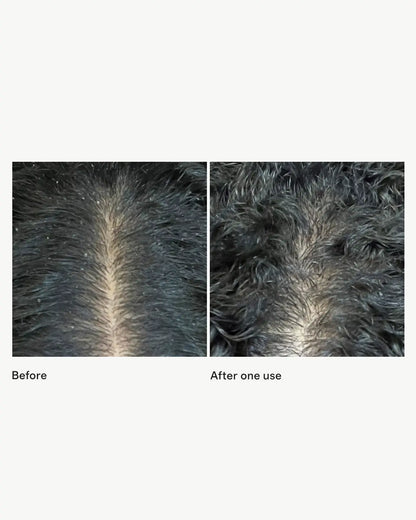Scalp Revival™ Micro-Exfoliating Shampoo 32 oz by Briogeo - US 9478
